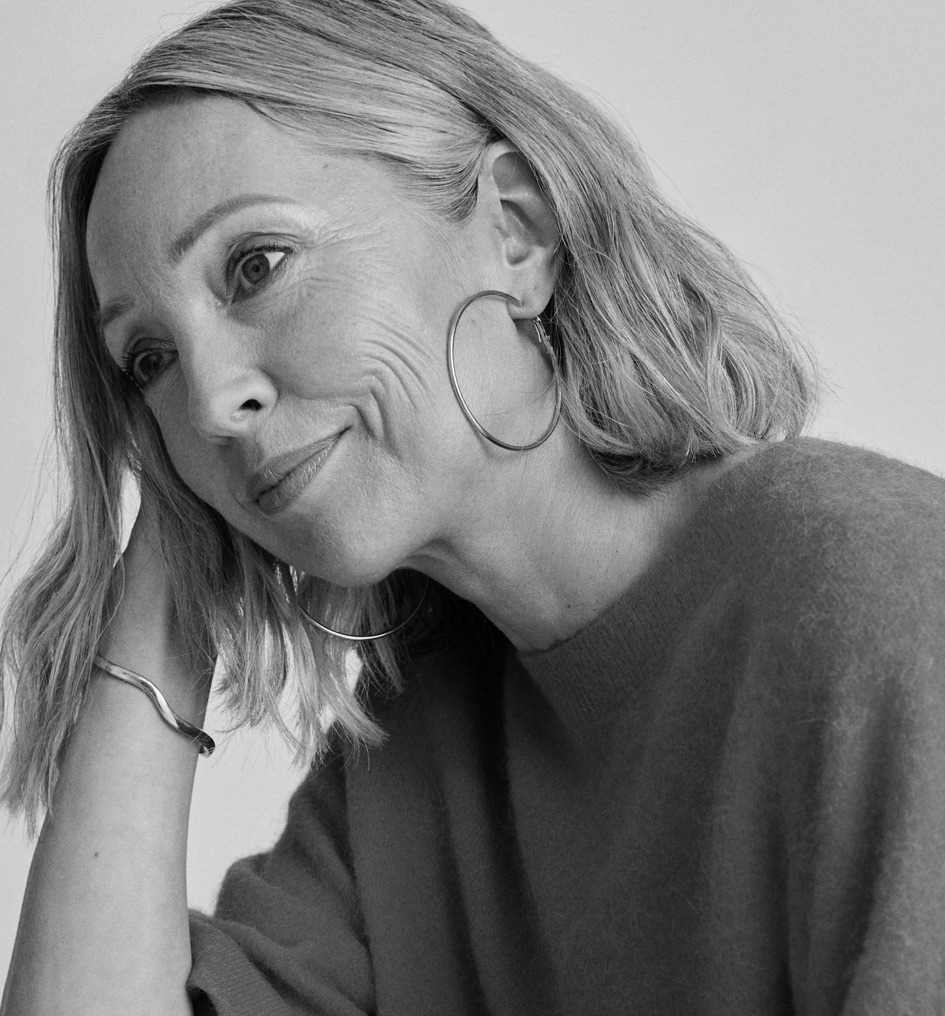 Onze behandeling - Radiesse - Dokter Robert Logger